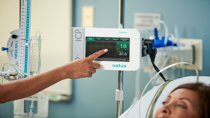 Reliable ICP monitoring data in your ICU