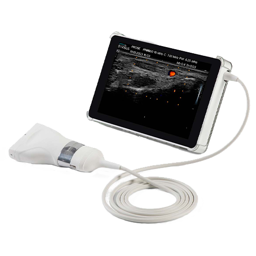 Invisus Pro for Neuromuscular ultrasound from Natus