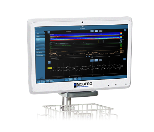 Moberg CNS Monitor
