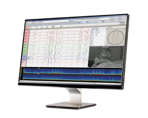 NEUROWERK EEG Software