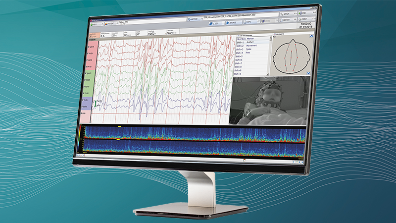 NEUROWERK EEG software on a monitor