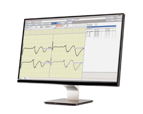 NEUROWERK EMG Software