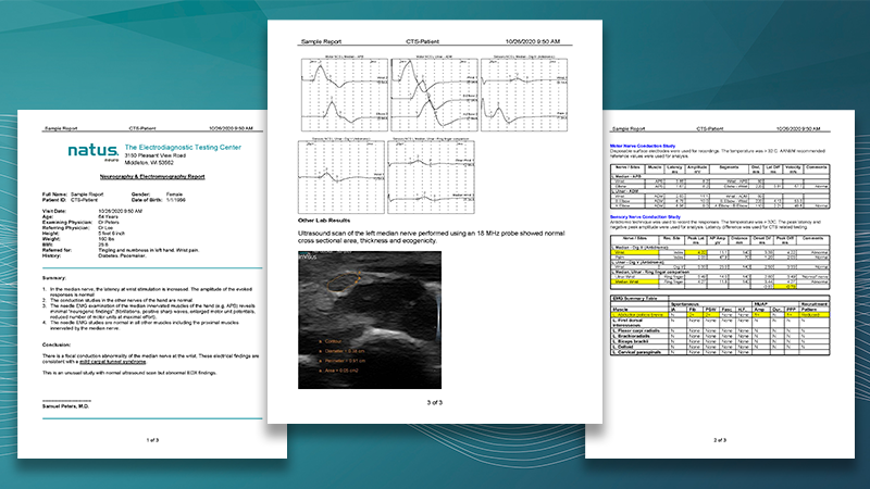 Natus Elite 2 Reporting