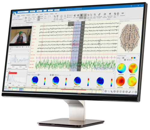 BRAIN QUICK® EEG Software