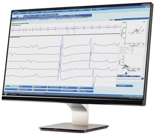 Dantec Keypoint.Net Software EMG acquisition screen