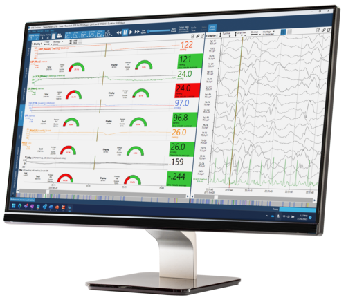 Moberg CNS Envision Software on a monitor