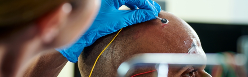 Attaching electrodes on the scalp